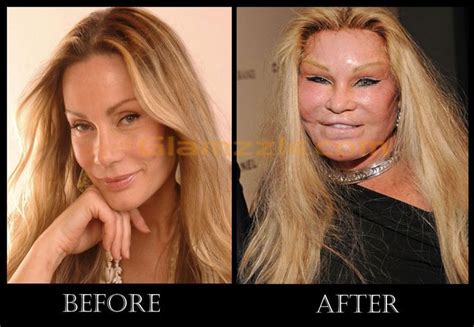 jocelyn wildenstein original face.